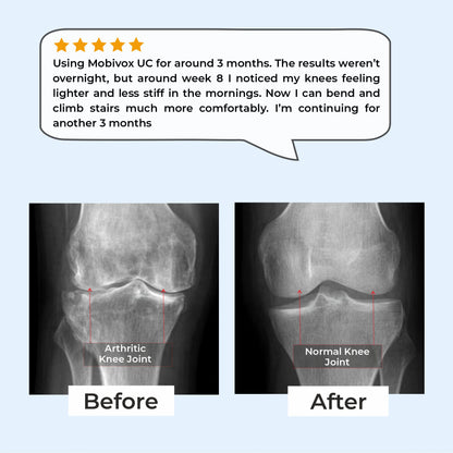 Mobivox UC – Reduce Knee & Joint Pain in Just 12 Weeks