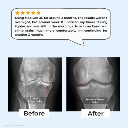Mobivox UC – Reduce Knee & Joint Pain in Just 12 Weeks