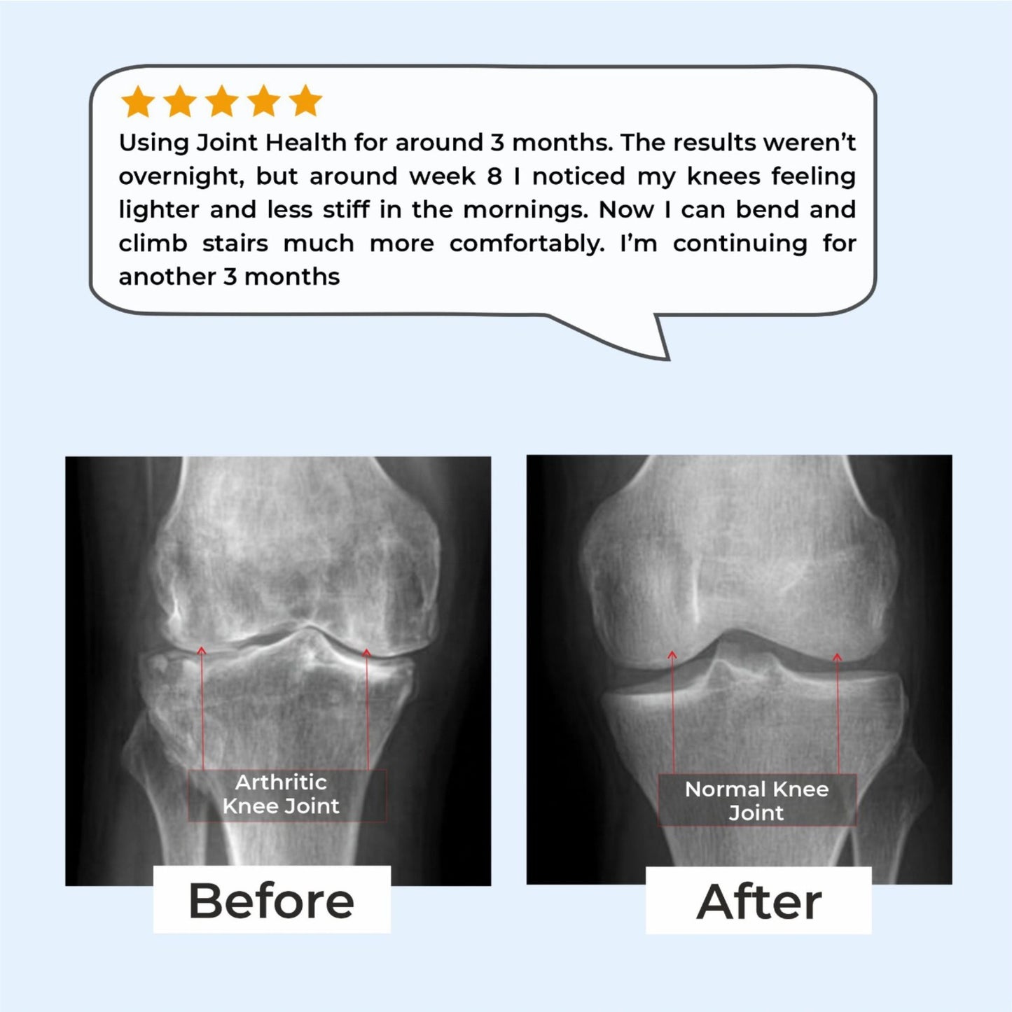 Joint Health – Knee Pain Relief & Cartilage Support